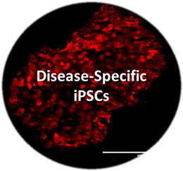 Disease-Specific iPSCs